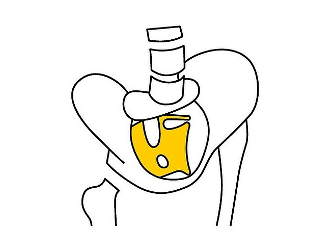 Illustration, welche die Beckenbodenmuskulatur von oben zeigt